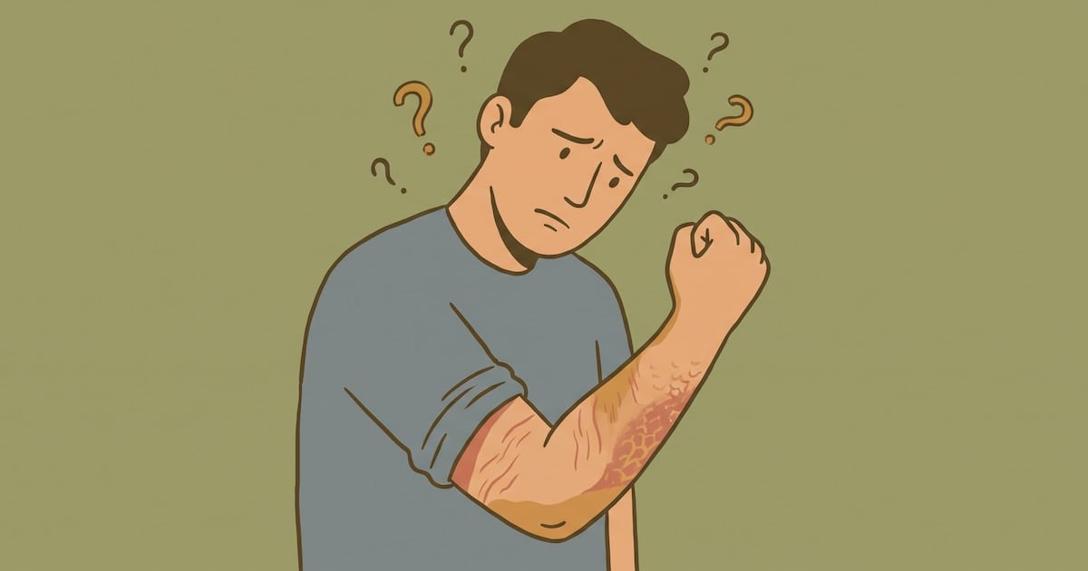 Piel que pica: cómo distinguir una simple sequedad de un eccema y cuándo conviene ir al dermatólogo