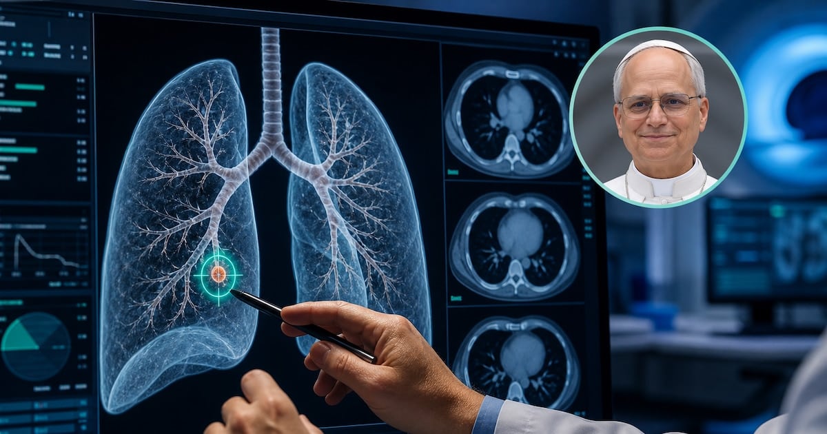 Operan al papa León XIV de un nódulo pulmonar minúsculo y dos especialistas explican por qué no hay que asustarse