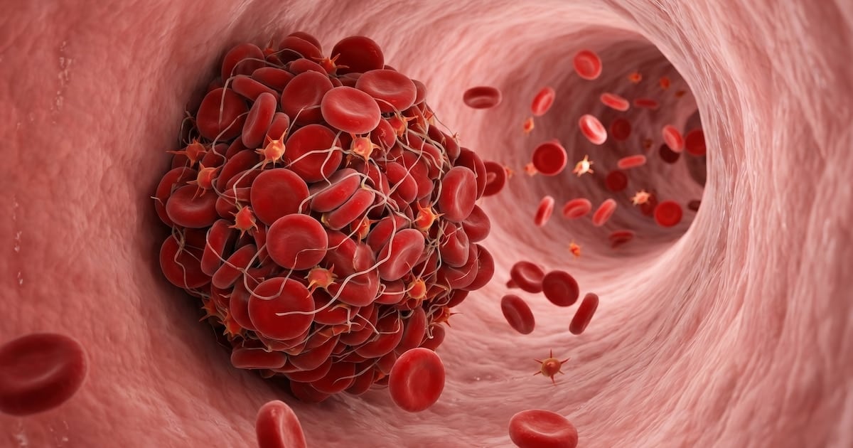 Cuando el cuerpo avisa: cómo reconocer un coágulo sanguíneo antes de que sea una emergencia