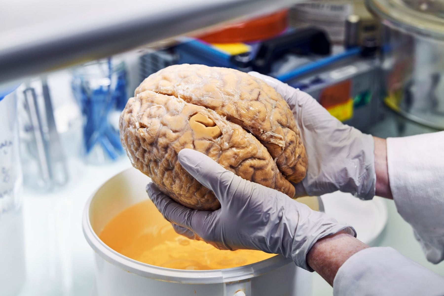La pandemia impactó en el cerebro, incluso sin haber tenido COVID