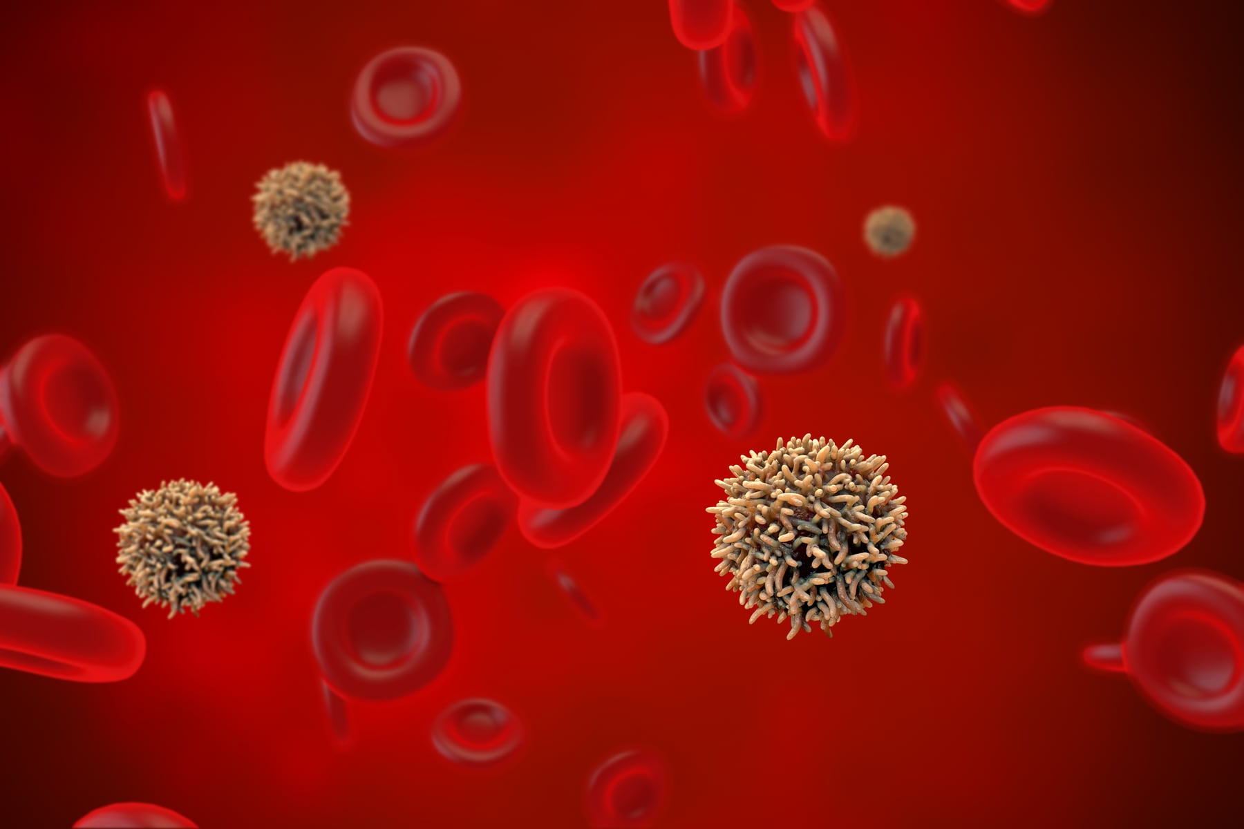 Mieloma múltiple: el cáncer silencioso de la sangre que preocupa a médicos