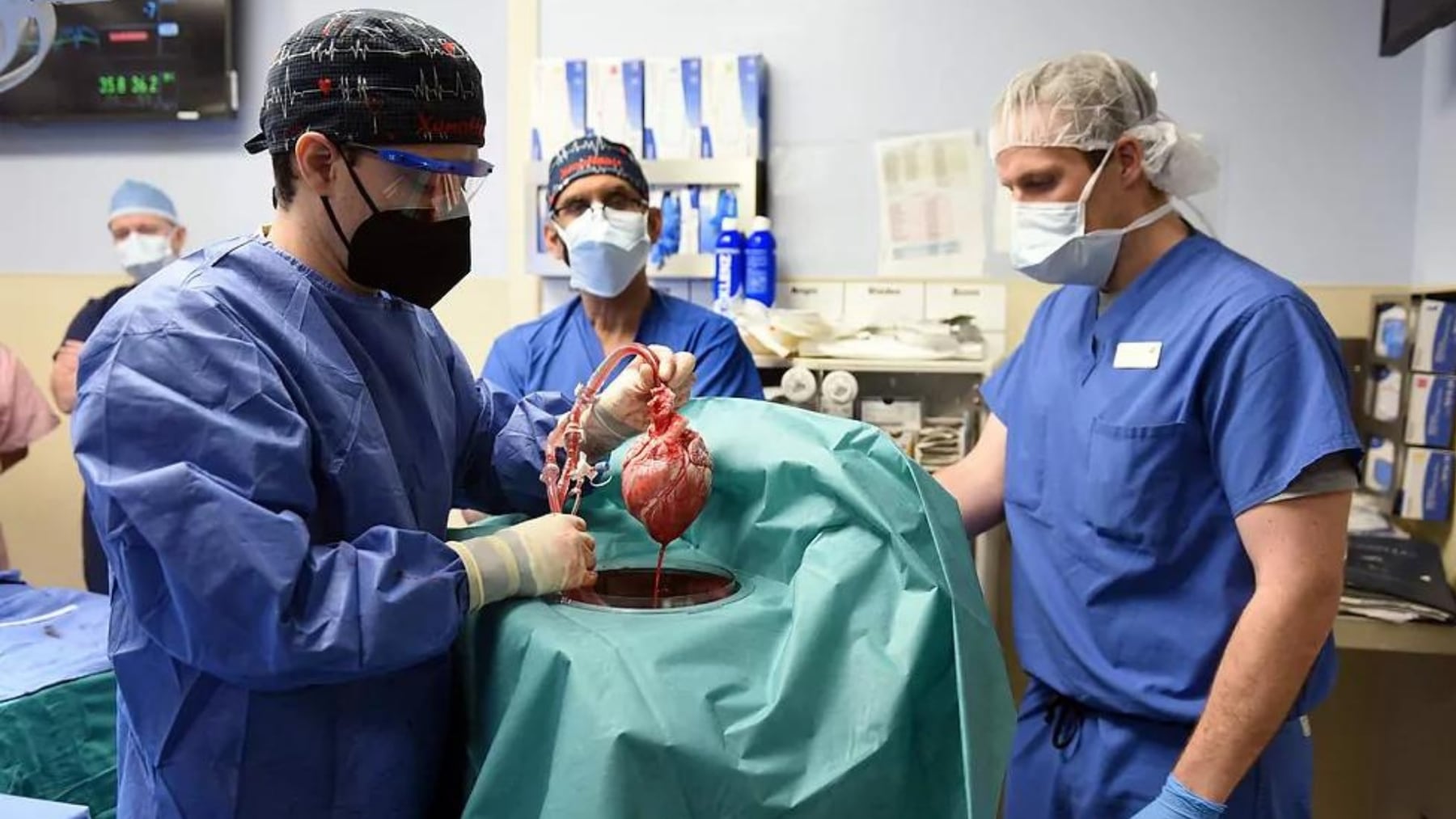 Luz verde al primer ensayo clínico de trasplante de órganos de cerdo en humanos en EE.UU.