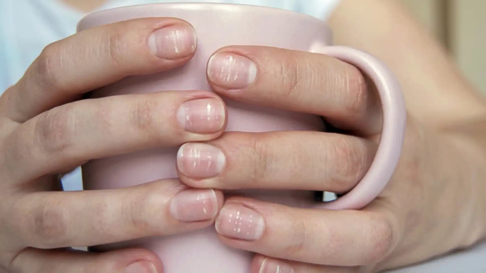 Un experto de Harvard reveló la sorprendente relación entre el crecimiento de las uñas y la longevidad